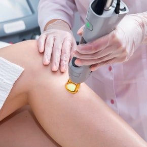 Epilation laser